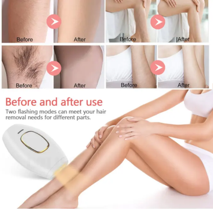 IPL Laser Hair Removal Machine